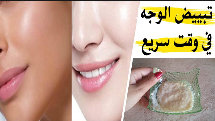 أسهل وصفات لتبييض الوجه في يوم واحد وازالة البقع الغامقة من أول مرة