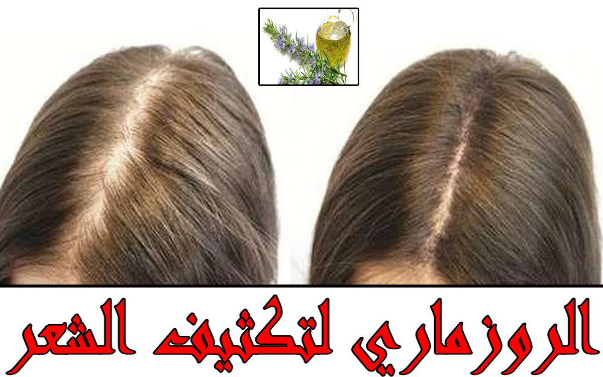 ماسك الروزماري للشعر لتكثيفه وتطويله بسرعة الصاروخ
