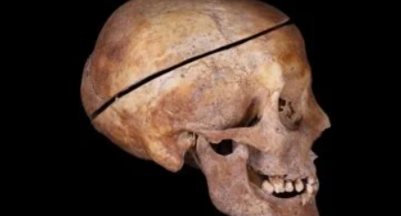 أول دليل على التحنيط في أوروبا يكشف أسراره