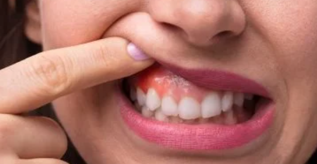 10 عادات تضر بصحة أسنانك ولثتك.. تجنبها